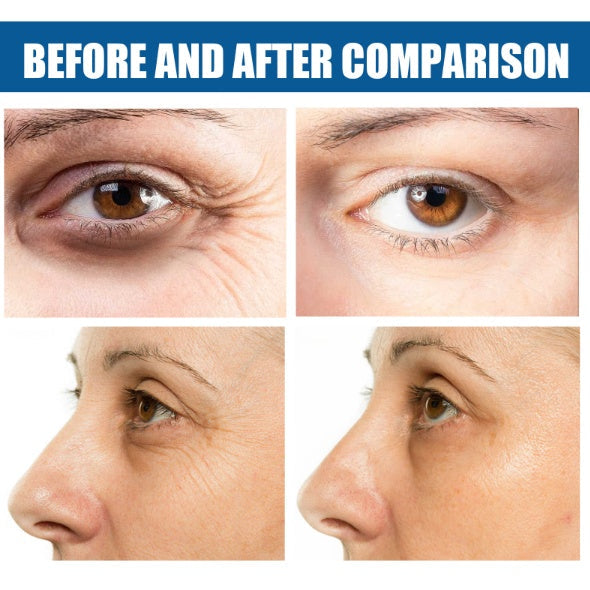 Collagen Eye Mask To Remove Fine Lines And Dark Circles Crystal Eye