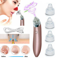 Electric Blackhead Vacuum Cleaner Pore Cleaner Acne Remover